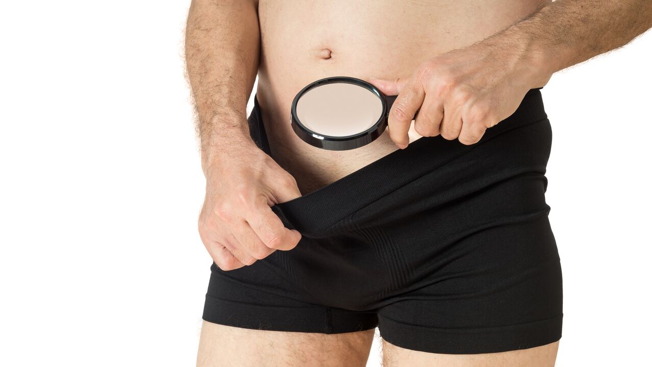 complejo masculino